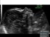 Consultorio de medicina materno fetal-embarazo, control